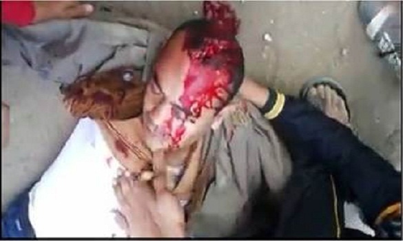 مسيرات جمعة «مليونية الشعب يشعل الثورة» 17 قتيلا وعشرات الجرحى