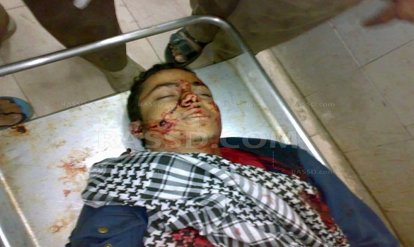 عشية 25 يناير.. ارتفاع ضحايا التظاهرات بمصر إلى 13 قتيلاً