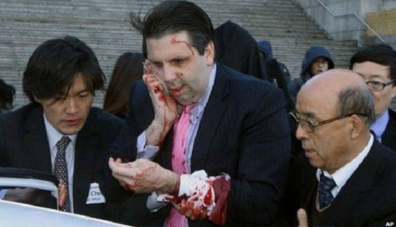 الاعتداء على السفير الأمريكي في سيول بسكين في الوجه