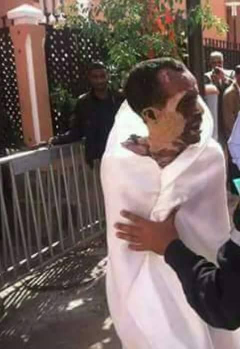 بالصور.. مواطن يضرم النار في جسده بالعيون