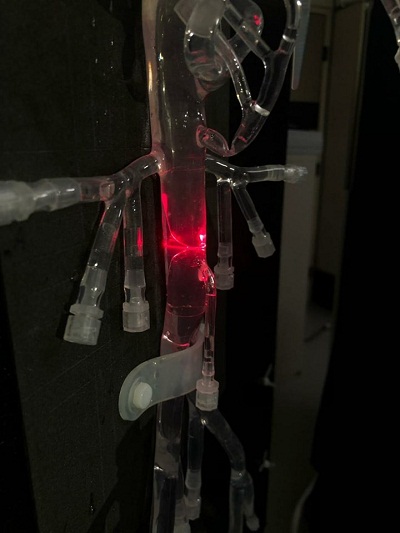 المغربي يوسف العزوزي المهتم بمرضى القلب يتأهل لنصف النهائي في مسابقة "نجوم العلوم" بقطر