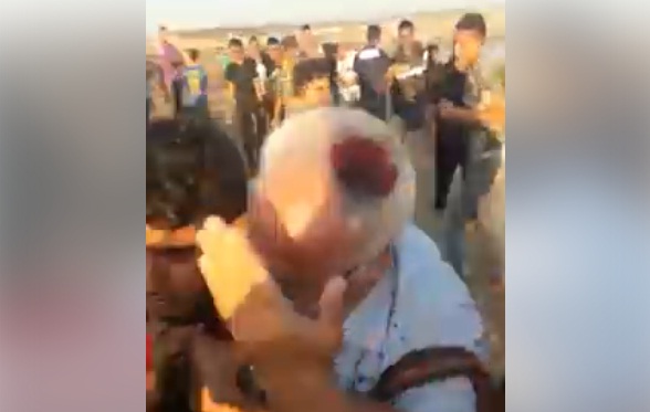 فيديو.. إصابة فلسطيني بقنبلة غاز في رأسه خلال مشاركته في مسيرات العودة شرق البريج وسط قطاع غزة